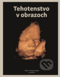 Tehotenstvo v obrazoch - Michal Holáň a kolektív