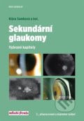Sekundární glaukomy - Klára Samková