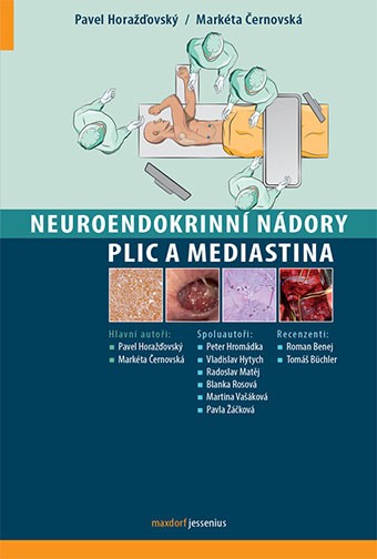 Neuroendokrinní nádory plic a mediastina kúpite na Gorila.sk