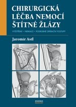 Chirurgická léčba nemocí štítné žlázy kúpite na Gorila.sk