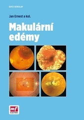 Makulární edémy - Ernest Jan kúpite na Gorila.sk