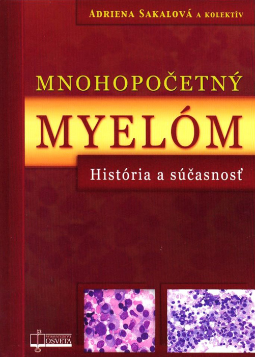 Kniha Mnohopočetný myelóm - Kolektív autorov,Adriena Sakalová