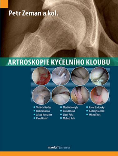 Artroskopie kyčelního kloubu kúpite na Gorila.sk