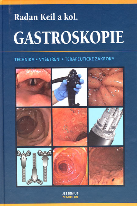 Kniha Gastroskopie