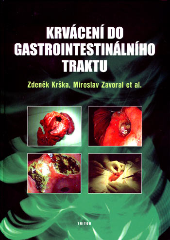 Krvácení do gastrointestinálního traktu - Zdeněk Krška kúpite na Gorila.sk