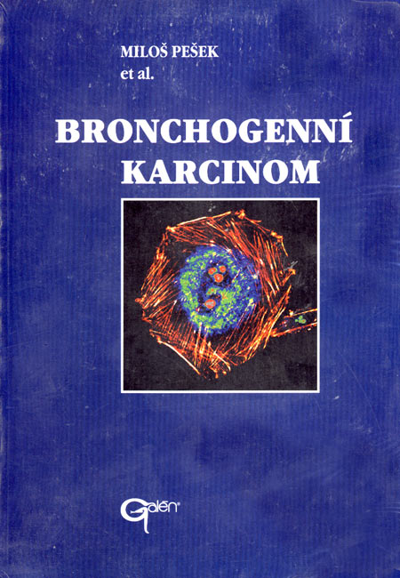 Bronchogenní karcinom