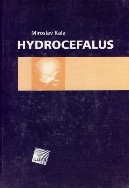 Kniha Hydrocefalus