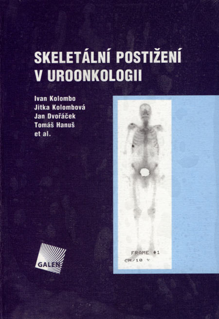 Kniha Skeletální postižení v uroonkologii