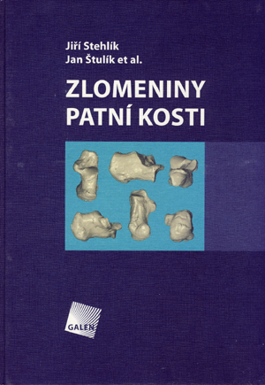 Kniha Zlomeniny patní kosti