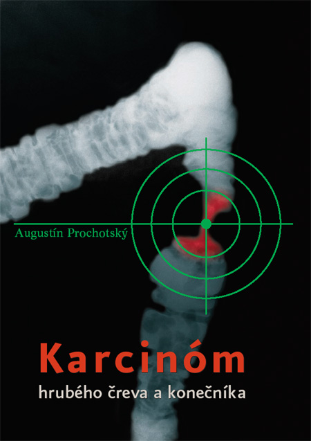 Kniha Karcinóm hrubého čreva a konečníka
