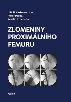 Zlomeniny proximálního femuru kúpite na Gorila.sk