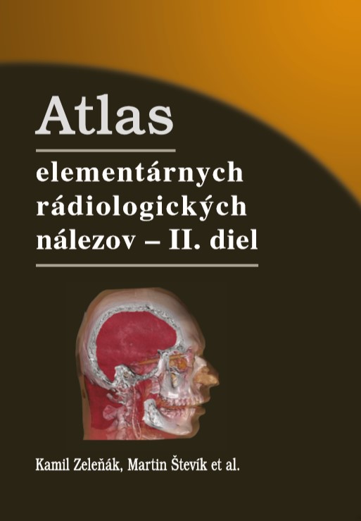 Atlas elementárnych rádiologických nálezov - II. diel - Kamil Zeleňák kúpite na Gorila.sk